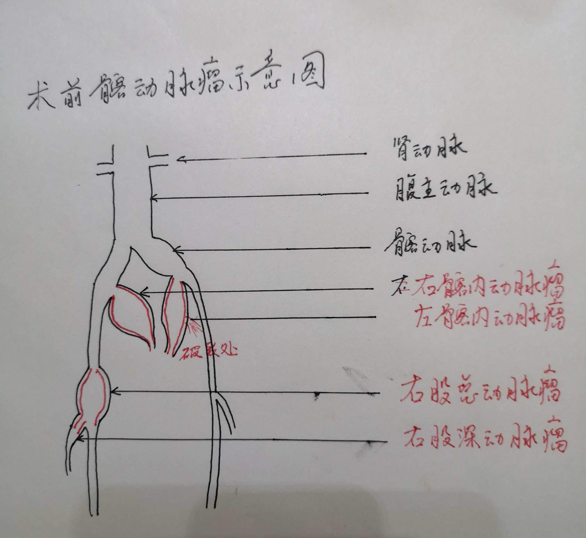 《人体解剖学》十二指肠
